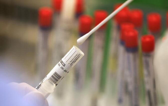 Ein Abstrich wird in einem Labor auf das Coronavirus untersucht
