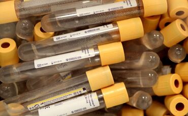 Corona Coronavirus Test Coronatest Symbol Symbolbild symbolfoto