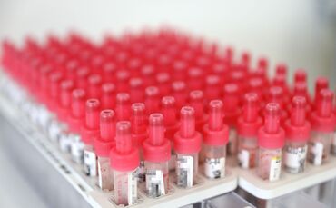 Labor Klinikum
