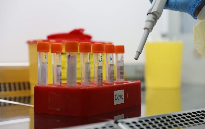 Labor Klinikum PCR Test PCR-Test Coronatest Corona-Test