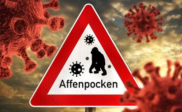 Warnschild mit Aufschrift Affenpocken, Affen Pocken FOTOMONTAGE