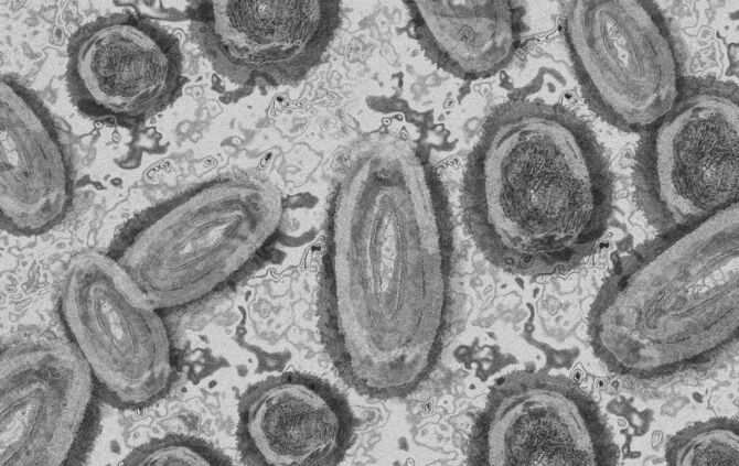 Affenpocken Symbolbild