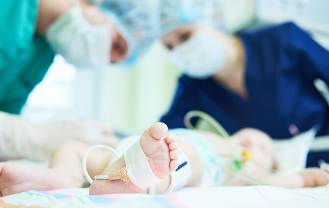 Neonatal Resuscitation. Doctor's team doing intensive therapy to newborn baby