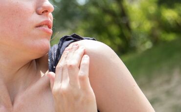 Mückenstiche sollte man niemals aufkratzen.