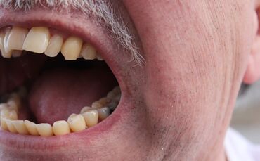 Schrei Zorn Reichsbürger Symbol Wut Symbolbild_0