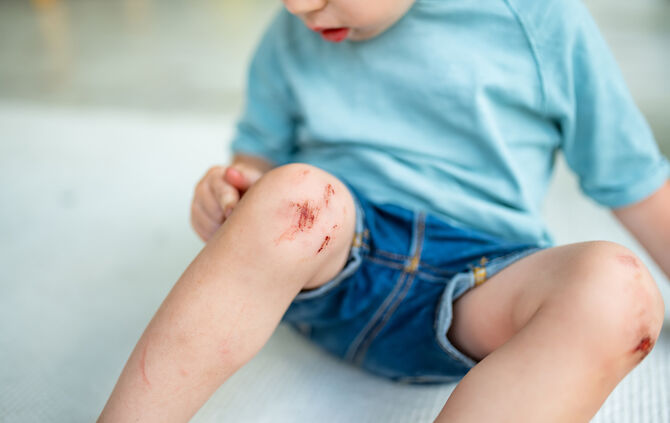Toddler boy with scraped knees. Parent helping her child perform first aid knee injury after an accident.