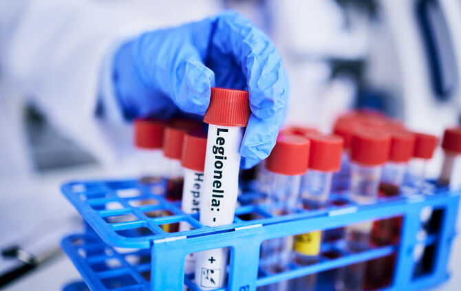 Scientist, hand and bacteria sample in test tube, person in lab with medical research and healthcare study. Doctor, gloves and v