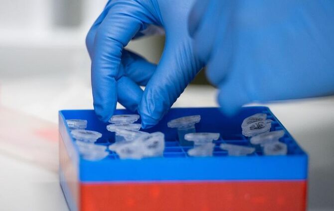 Eine Laborantin führt Untersuchungen zum Coronavirus durch