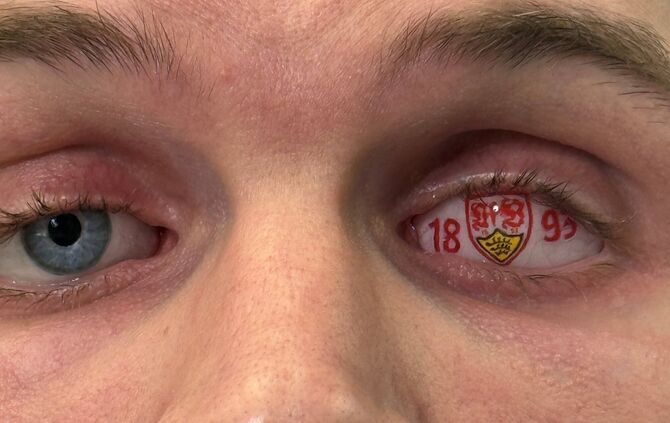 vfb-auge2 - 1