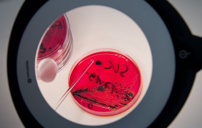 Wegen Salmonellen ruft der Hersteller Dog's Nature GmbH Schweineohren ohne Muschel für Hunde zurück. (Symbolbild)