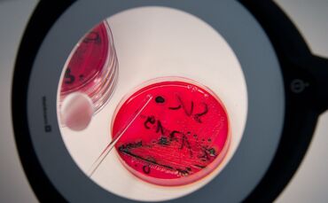 Wegen Salmonellen ruft der Hersteller Dog's Nature GmbH Schweineohren ohne Muschel für Hunde zurück. (Symbolbild)