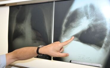 Im Winter weniger zu lüften, kann die Belastung mit krebserregendem Radon in der Wohnung erhöhen. (Archivbild)