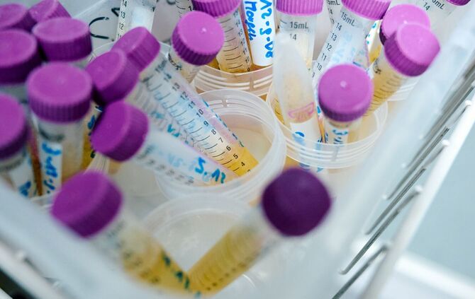 MnHexP ist ein Abbauprodukt des Weichmachers Di-n-hexylphthalat (DnHexP), der als fortpflanzungsschädigend gilt. (Symbolbild)