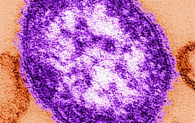 Masern - Virus