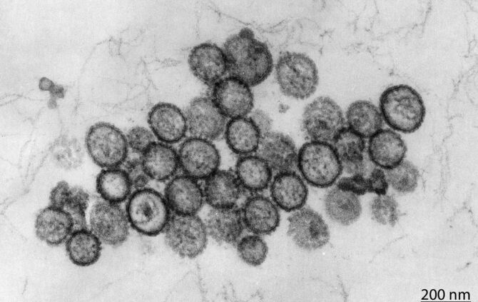 Hantavirus